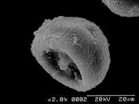 スギ花粉の電子顕微鏡写真